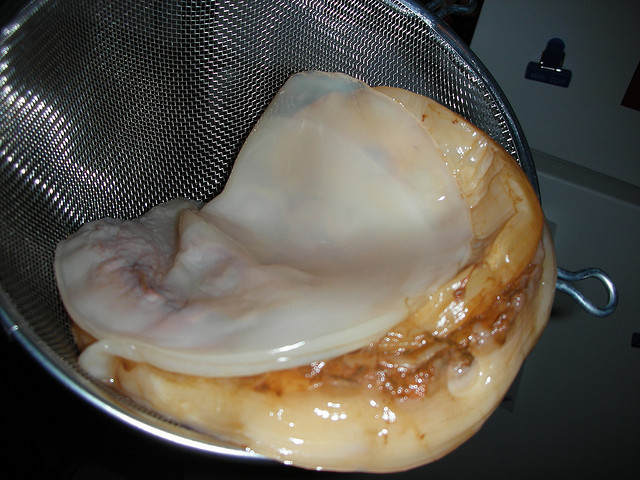 Kombuha – gljiva dugovečnosti