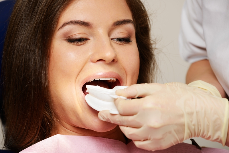 http://www.dreamstime.com/royalty-free-stock-images-dentist-making-teeth-whitening-procedure-to-woman-patient-image37740219