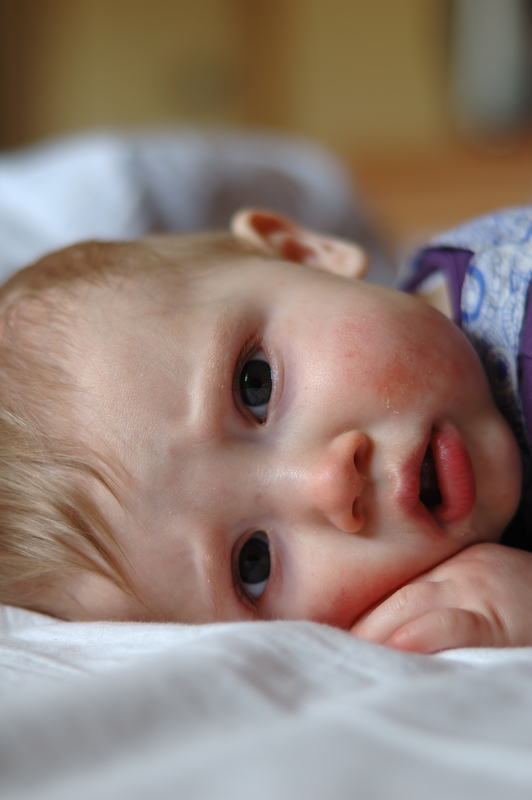 http://www.dreamstime.com/stock-photo-eight-month-old-sick-baby-lying-bed-image6087620