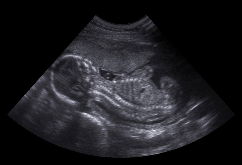 http://www.dreamstime.com/stock-photos-ultrasound-diagnosis-pregnant-women-image21192833